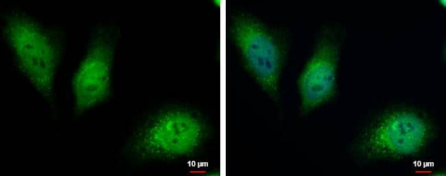 Immunocytochemistry/ Immunofluorescence HKDC1 Antibody - BSA Free