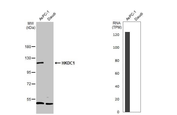 Western Blot HKDC1 Antibody - BSA Free
