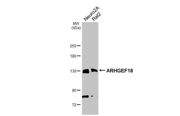 Various whole cell extracts (30 ug) were separated by 5% SDS-PAGE, and the membrane was blotted with ARHGEF18 antibody [GT1972] (NBP2-43546) diluted at 1:1000. The HRP-conjugated anti-mouse IgG antibody  was used to detect the primary antibody. 