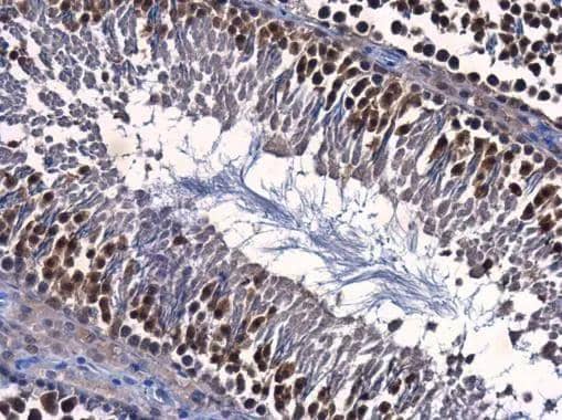 Immunohistochemistry-Paraffin ENY2 Antibody (245) - Azide and BSA Free