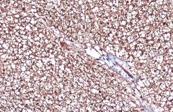 UCP1 antibody [GT3111] detects UCP1 protein at cytoplasm by immunohistochemical analysis.Sample: Paraffin-embedded mouse brown adipocyte.UCP1 stained by UCP1 antibody [GT3111] (NBP2-43550) diluted at 1:200.Antigen Retrieval: Citrate buffer, pH 6.0, 15 min 