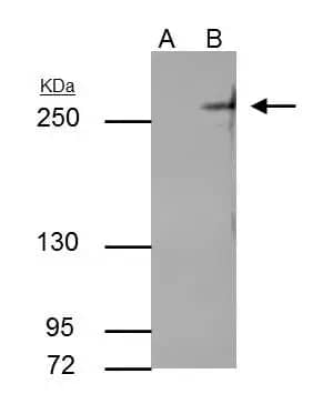 Immunoprecipitation: TET2 Antibody (649) [NBP2-43552] - TET2 antibody [GT649] immunoprecipitates TET2 protein in IP experiments.IP samples: 30 ug whole cell extract of TET2-transfected 293T cells.A. Control with 5 ug of preimmune Rabbit IgGB. Immunoprecipitation of TET2 protein by 5 ug TET2 antibody [GT649] (NBP2-43552)5 % SDS-PAGEThe immunoprecipitated TET2 protein was detected by TET2 antibody [GT649] (NBP2-43552) diluted at 1:1000.[EasyBlot anti-rabbit IgG  was used as a secondary reagent]