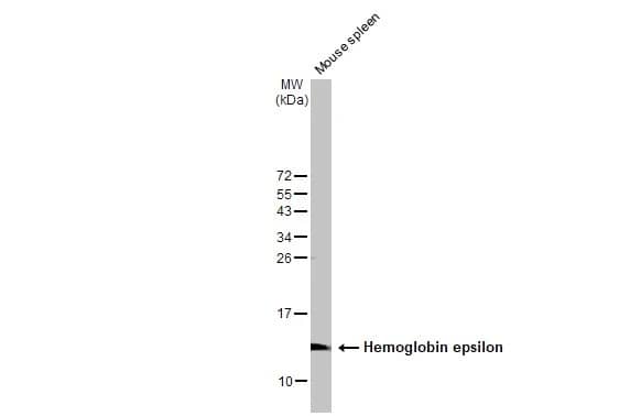 Western Blot: Hemoglobin epsilon Antibody [NBP2-43557] - Mouse tissue extract (50 ug) was separated by 15% SDS-PAGE, and the membrane was blotted with Hemoglobin epsilon antibody [N1N2], N-term (NBP2-43557) diluted at 1:1000. The HRP-conjugated anti-rabbit IgG antibody  was used to detect the primary antibody.