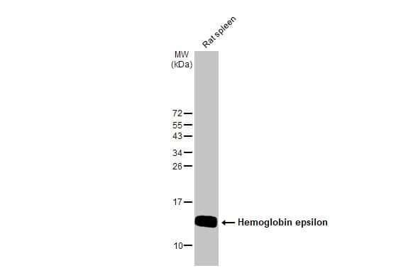 <b>Biological Strategies Validation. </b>Western Blot: Hemoglobin epsilon Antibody [NBP2-43557] - Rat tissue extract (50 ug) was separated by 15% SDS-PAGE, and the membrane was blotted with Hemoglobin epsilon antibody [N1N2], N-term (NBP2-43557) diluted at 1:1000. The HRP-conjugated anti-rabbit IgG antibody  was used to detect the primary antibody.