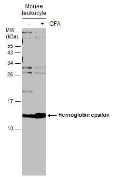 Untreated (-) and treated (+) mouse tissue extracts (30 ug) were separated by 15% SDS-PAGE, and the membrane was blotted with Hemoglobin epsilon antibody [N1N2], N-term (NBP2-43557) diluted at 1:500. (CFA: Complete Freunds adjuvant) 
