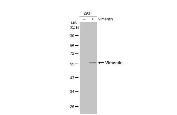 Western Blot: Vimentin Antibody (812) [NBP2-43560] - Non-transfected (-) and transfected (+) 293T whole cell extracts (10 ug) were separated by 10% SDS-PAGE, and the membrane was blotted with Vimentin antibody [GT812] (NBP2-43560) diluted at 1:10000. The HRP-conjugated anti-mouse IgG antibody  was used to detect the primary antibody.