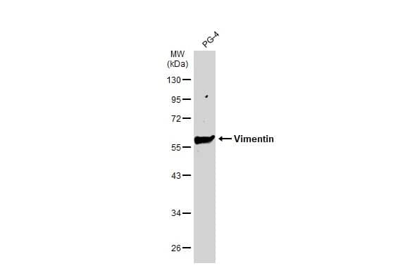 Western Blot: Vimentin Antibody (812) [NBP2-43560] - Whole cell extract (30 ug) was separated by 10% SDS-PAGE, and the membrane was blotted with Vimentin antibody (NBP2-43560) diluted at 1:500000. The HRP-conjugated anti-mouse IgG antibody  was used to detect the primary antibody, and the signal was developed with Trident ECL plus-Enhanced.