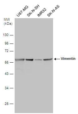 Various whole cell extracts (30 ug) were separated by 10% SDS-PAGE, and the membrane was blotted with Vimentin antibody [GT812] (NBP2-43560) diluted at 1:5000. 