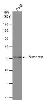 Whole cell extract (30 ug) was separated by 10% SDS-PAGE, and the membrane was blotted with Vimentin antibody [GT812] (NBP2-43560) diluted at 1:75000. 