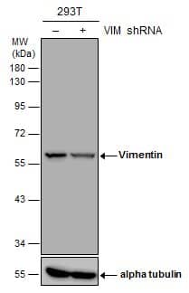 <b>Genetic Strategies Validation. </b>Non-transfected (-) and transfected (+) 293T whole cell extracts (30 ug) were separated by 10% SDS-PAGE, and the membrane was blotted with Vimentin antibody [GT812] (NBP2-43560) diluted at 1:5000. 