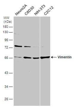 Various whole cell extracts (30 ug) were separated by 10% SDS-PAGE, and the membrane was blotted with Vimentin antibody [GT812] (NBP2-43560) diluted at 1:3000. 