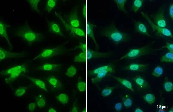 Immunocytochemistry/ Immunofluorescence: ATR [p Thr1989] Antibody (222) [NBP2-43564] - ATR antibody [GT222] detects ATR  protein at nucleus by immunofluorescent analysis.Sample: HeLa cells were fixed in 4% paraformaldehyde at RT for 15 min.Green: ATR  stained by ATR antibody [GT222] (NBP2-43564) diluted at 1:500.Blue: Fluoroshield with DAPI .