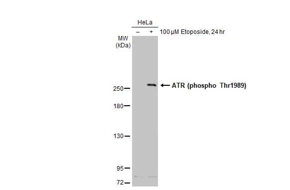 Western Blot: ATR [p Thr1989] Antibody (222) [NBP2-43564] - Untreated (-) and treated (+) HeLa whole cell extracts (30 ug) were separated by 5% SDS-PAGE, and the membrane was blotted with ATR antibody [GT222] (NBP2-43564) diluted at 1:500. The HRP-conjugated anti-mouse IgG antibody  was used to detect the primary antibody.