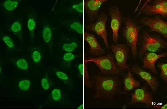 Immunocytochemistry/ Immunofluorescence: ATR [p Thr1989] Antibody (222) [NBP2-43564] - ATR antibody [GT222] detects ATR  protein at nucleus by immunofluorescent analysis.Sample: HeLa cells were fixed in 4% paraformaldehyde at RT for 15 min.Green: ATR  stained by ATR antibody [GT222] (NBP2-43564) diluted at 1:500.Red: alpha Tubulin, a cytoskeleton marker, stained by alpha Tubulin antibody  diluted at 1:1000.