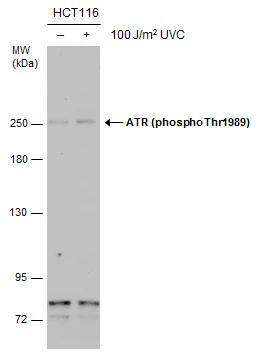 Untreated (-) and treated (+) HCT116 whole cell extracts (30 ug) were separated by 5% SDS-PAGE, and the membrane was blotted with ATR (phospho Thr1989) antibody [GT222] (NBP2-43564) diluted at 1:500. The signal was developed with Trident ECL plus-Enhanced. 