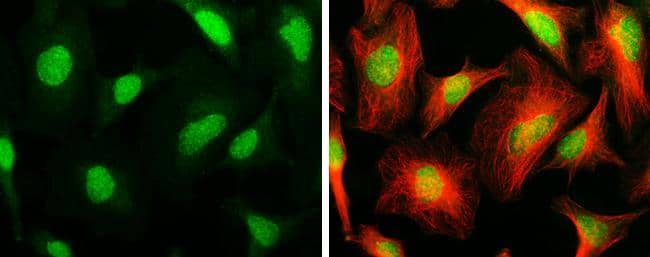 ARID1A antibody [GT3611] detects ARID1A protein at nucleus by immunofluorescent analysis.Sample: HeLa cells were fixed in ice-cold MeOH for 5 min.Green: ARID1A stained by ARID1A antibody [GT3611] (NBP2-43566) diluted at 1:200.Red: alpha Tubulin 4a, a cytoskeleton marker, stained by alpha Tubulin 4a antibody  diluted at 1:500. 