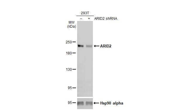 Western Blot: ARID2 Antibody (7311) [NBP2-43567] - Non-transfected (–) and transfected (+) 293T whole cell extracts (50 ug) were separated by 5% SDS-PAGE, and the membrane was blotted with ARID2 antibody [GT7311]  diluted at 1:1000. The HRP-conjugated anti-mouse IgG antibody  was used to detect the primary antibody, and the signal was developed with Trident ECL plus-Enhanced.