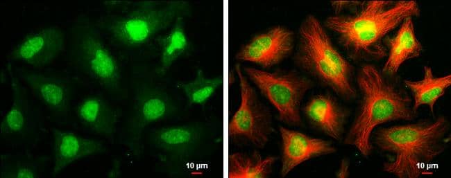 ARID2 antibody [GT7311] detects ARID2 protein at nucleus by immunofluorescent analysis.Sample: HeLa cells were fixed in ice-cold MeOH for 5 min.Green: ARID2 stained by ARID2 antibody [GT7311] (NBP2-43567) diluted at 1:500.Red: alpha Tubulin 4a, a cytoskeleton marker, stained by alpha Tubulin 4a antibody  diluted at 1:500.Scale bar= 10um. 