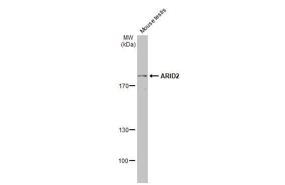 Western Blot ARID2 Antibody (7311) - Azide and BSA Free