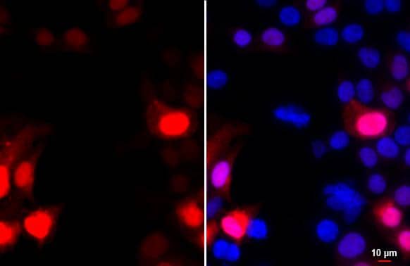 GFP antibody [GT859] detects GFP protein by immunofluorescent analysis.Sample: GFP-tag tagged protein transfected 293T cells were fixed in 4% paraformaldehyde at RT for 15 min.Red: GFP stained by GFP antibody [GT859] (NBP2-43575) diluted at 1:2000.Blue: Hoechst 33342 staining. 