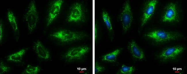 Fumarate hydratase antibody [GT7612] detects Fumarate hydratase protein at mitochondria by immunofluorescent analysis.Sample: HeLa cells were fixed in ice-cold MeOH for 5 min.Green: Fumarate hydratase protein stained by Fumarate hydratase antibody [GT7612] (NBP2-43578) diluted at 1:200.Blue: Hoechst 33342 staining.Scale bar = 10 um. 
