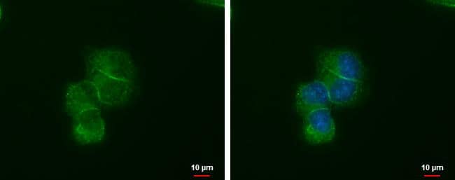 LIN7A antibody [GT377] detects LIN7A protein at junction by immunofluorescent analysis.Sample: MCF-7 cells were fixed in ice-cold MeOH for 5 min.Green: LIN7A protein stained by LIN7A antibody [GT377] (NBP2-43587) diluted at 1:1000.Blue: Hoechst 33342 staining. 