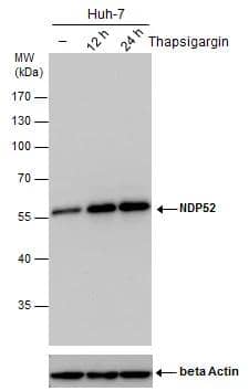 NDP52 antibody detects NDP52 protein by western blot analysis. Un-treated (-) and treated (+, Thapsigargin treatment for 12hrs and 24hrs) Huh-7 whole cell extracts (30 ug) were separated by 10% SDS-PAGE, and the membrane was blotted with NDP52 antibody (NBP2-43588) diluted by 1:500.The ACTB was used as internal control  shown at the bottom panel. 
