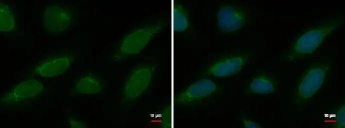 Nucleoporin p62 antibody [GT252] detects Nucleoporin p62 protein at nuclear envelope by immunofluorescent analysis. Sample: HeLa cells were fixed in ice-cold MeOH for 5 min.Green: Nucleoporin p62 protein stained by Nucleoporin p62 antibody [GT252] (NBP2-43589) diluted at 1:500.Blue: Hoechst 33342 staining. 