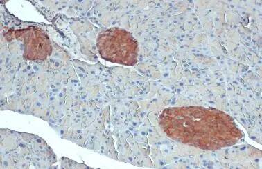 Immunohistochemistry-Paraffin: O-GlcNAc Transferase p110 subunit Antibody (678) [NBP2-43590] - O-GlcNAc Transferase p110 subunit antibody [GT678] detects O-GlcNAc Transferase p110 subunit protein at cytoplasm of islet by immunohistochemical analysis.Sample: Paraffin-embedded mouse pancreas.O-GlcNAc Transferase p110 subunit stained by O-GlcNAc Transferase p110 subunit antibody [GT678] (NBP2-43590) diluted at 1:200.Antigen Retrieval: Citrate buffer, pH 6.0, 15 min