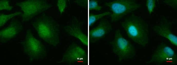 Immunocytochemistry/ Immunofluorescence O-GlcNAc Transferase p110 subunit Antibody (678) - Azide and BSA Free