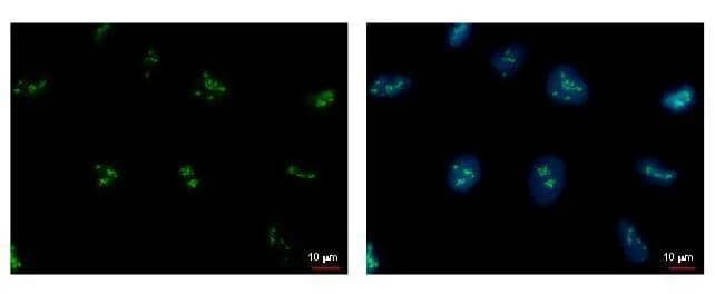 CD3EAP antibody detects CD3EAP protein at Nucleus by immunofluorescent analysis. Sample: U2OS cells were fixed in 4% paraformaldehyde/PBS for 15 min.Green: CD3EAP protein stained by CD3EAP antibody (NBP2-43592) diluted at 1:500.Blue: Hoechst 33342 staining. 