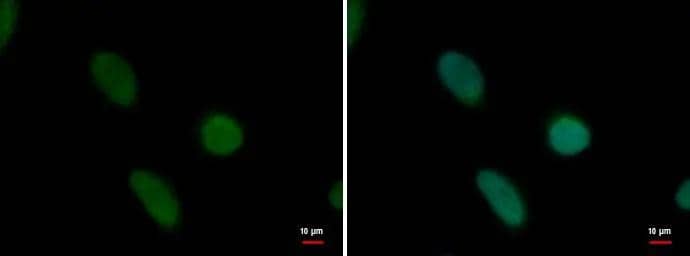 PRDM14 antibody [GT1359] detects PRDM14 protein at nucleus by immunofluorescent analysis.Sample: HeLa cells were fixed in 4% paraformaldehyde at RT for 15 min.Green: PRDM14 protein stained by PRDM14 antibody [GT1359] (NBP2-43593) diluted at 1:1000.Blue: Hoechst 33342 staining. 