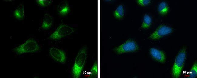Ribosome binding protein 1 antibody [GT5610] detects Ribosome binding protein 1 protein at endoplasmic reticulum by immunofluorescent analysis.Sample: HeLa cells were fixed in 4% paraformaldehyde at RT for 15 min.Green: Ribosome binding protein 1 protein stained by Ribosome binding protein 1 antibody [GT5610] (NBP2-43600) diluted at 1:2000.Blue: Hoechst 33342 staining.Scale bar = 10 um. 