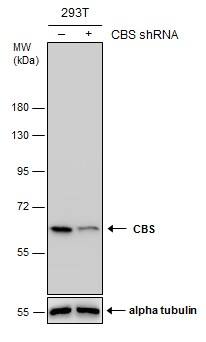 <b>Genetic Strategies Validation. </b>Non-transfected (-) and transfected (+) 293T whole cell extracts (30 ug) were separated by 7.5% SDS-PAGE, and the membrane was blotted with CBS antibody [GT519] (NBP2-43604) diluted at 1:500. 