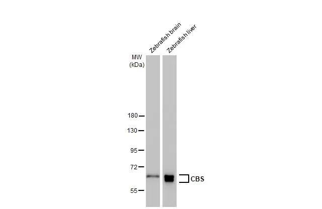 Various tissue extracts (30 ug) were separated by 7.5% SDS-PAGE, and the membrane was blotted with CBS antibody [GT519] (NBP2-43604) diluted at 1:1000. The HRP-conjugated anti-mouse IgG antibody  was used to detect the primary antibody. 