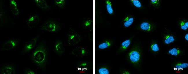 Immunocytochemistry/ Immunofluorescence: Coatomer Subunit Delta Antibody (1318) [NBP2-43608] - Coatomer Subunit Delta antibody [GT1318] detects Coatomer Subunit Delta protein at Golgi apparatus by immunofluorescent analysis.Sample: HeLa cells were fixed in 4% paraformaldehyde at RT for 15 min.Green: Coatomer Subunit Delta stained by Coatomer Subunit Delta antibody [GT1318] (NBP2-43608) diluted at 1:500.Blue: Hoechst 33342 staining.Scale bar= 10um.