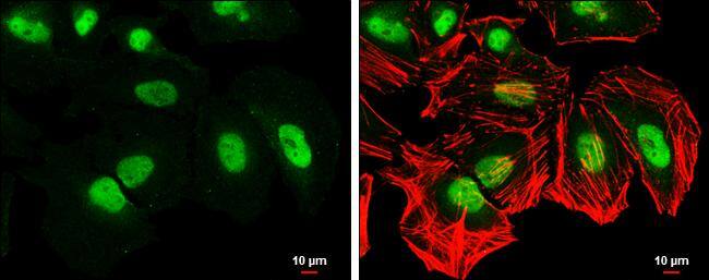 CSE1L antibody [GT5111] detects CSE1L protein at nucleus by immunofluorescent analysis.Sample: HeLa cells were fixed in 4% paraformaldehyde at RT for 15 min.Green: CSE1L stained by CSE1L antibody [GT5111] (NBP2-43609) diluted at 1:500.Red: phalloidin, a cytoskeleton marker, diluted at 1:100.Scale bar= 10um. 