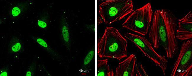 CSE1L antibody [GT729] detects CSE1L protein at nucleus by immunofluorescent analysis.Sample: HeLa cells were fixed in 4% paraformaldehyde at RT for 15 min.Green: CSE1L stained by CSE1L antibody [GT729] (NBP2-43610) diluted at 1:500.Red: phalloidin, a cytoskeleton marker, diluted at 1:100.Scale bar= 10um. 