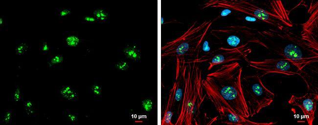 Immunocytochemistry/ Immunofluorescence GBX2 Antibody