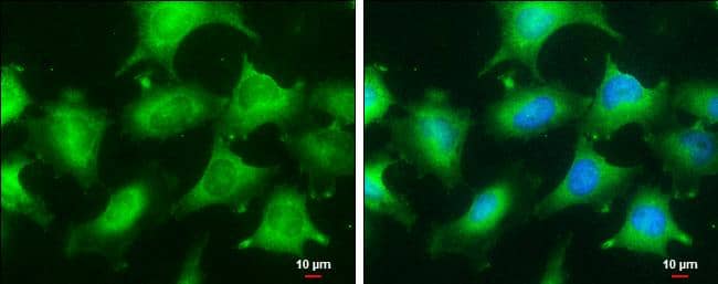 Glyoxalase I antibody [GT266] detects Glyoxalase I protein at cytoplasm by immunofluorescent analysis.Sample: HeLa cells were fixed in 4% paraformaldehyde at RT for 15 min.Green: Glyoxalase I stained by Glyoxalase I antibody [GT266] (NBP2-43618) diluted at 1:100.Blue: Hoechst 33342 staining.Scale bar= 10 um. 