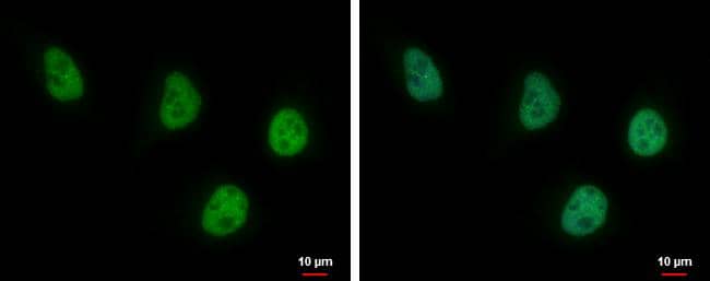 USP7 antibody [GT6512] detects USP7 protein at nucleus by immunofluorescent analysis.Sample: HeLa cells were fixed in 4% paraformaldehyde at RT for 15 min.Green: USP7 protein stained by USP7 antibody [GT6512] (NBP2-43619) diluted at 1:500.Blue: Hoechst 33342 staining. 