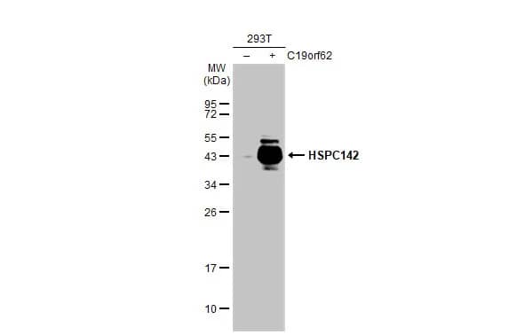 Western Blot: MERIT40/HSPC142 Antibody (1251) [NBP2-43621] - Non-transfected (-) and transfected (+) 293T whole cell extracts (30 ug) were separated by 12% SDS-PAGE, and the membrane was blotted with MERIT40/HSPC142 antibody [GT1251] (NBP2-43621) diluted at 1:5000. The HRP-conjugated anti-mouse IgG antibody  was used to detect the primary antibody.