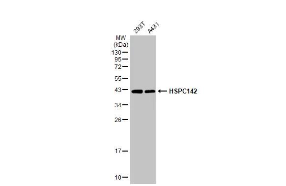 Western Blot: MERIT40/HSPC142 Antibody (1251) [NBP2-43621] - Various whole cell extracts (30 ug) were separated by 12% SDS-PAGE, and the membrane was blotted with MERIT40/HSPC142 antibody [GT1251] (NBP2-43621) diluted at 1:1000. The HRP-conjugated anti-mouse IgG antibody  was used to detect the primary antibody.