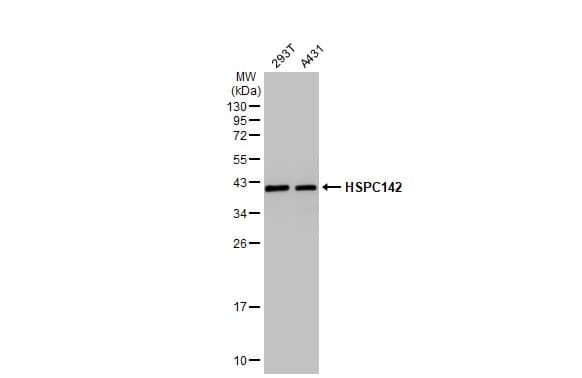 Western Blot: MERIT40/HSPC142 Antibody (2810) [NBP2-43622] - Various whole cell extracts (30 ug) were separated by 12% SDS-PAGE, and the membrane was blotted with MERIT40/HSPC142 antibody [GT2810] (NBP2-43622) diluted at 1:1000. The HRP-conjugated anti-mouse IgG antibody  was used to detect the primary antibody.