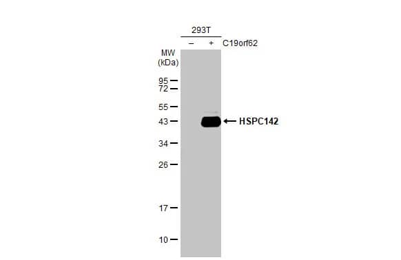 Western Blot: MERIT40/HSPC142 Antibody (2810) [NBP2-43622] - Non-transfected (-) and transfected (+) 293T whole cell extracts (30 ug) were separated by 12% SDS-PAGE, and the membrane was blotted with MERIT40/HSPC142 antibody [GT2810] (NBP2-43622) diluted at 1:5000. The HRP-conjugated anti-mouse IgG antibody  was used to detect the primary antibody.