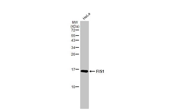 Western Blot: TTC11 Antibody (9810) [NBP2-43628] - Whole cell extract (30 ug) was separated by 15% SDS-PAGE, and the membrane was blotted with TTC11 antibody [GT9810] (NBP2-43628) diluted at 1:500. The HRP-conjugated anti-mouse IgG antibody  was used to detect the primary antibody.