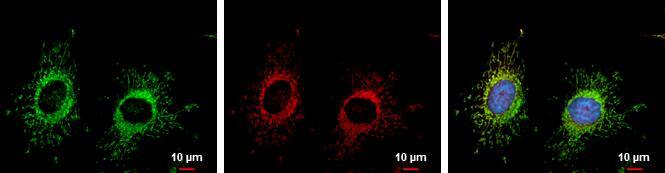 FIS1 antibody detects FIS1 protein at mitochondria by immunofluorescent analysis.Sample: HeLa cells were fixed in 2% paraformaldehyde/culture medium at 37oC for 30 min.Green: FIS1 protein stained by FIS1 antibody (NBP2-43628) diluted at 1:20000.Red: MitoTrackerR Red CMXRos, a mitochondria tracker.Blue: Hoechst 33342 staining.Scale bar = 10 um. 