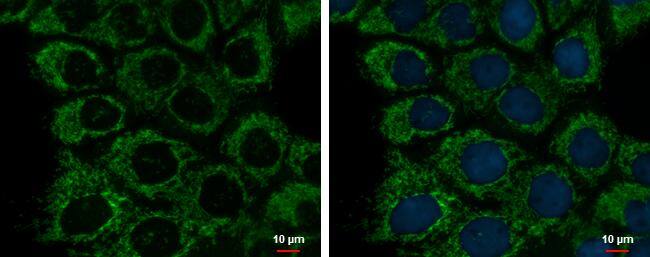 ETHE1 antibody [GT1621] detects ETHE1 protein at mitochondria by immunofluorescent analysis.Sample: A431 cells were fixed in 2% paraformaldehyde/culture medium at 37C for 30 min.Green: ETHE1 protein stained by ETHE1 antibody [GT1621] (NBP2-43632) diluted at 1:500.Blue: Hoechst 33342 staining. 