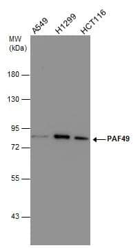 Various whole cell extracts (30 ug) were separated by 7.5% SDS-PAGE, and the membrane was blotted with PAF49 antibody (NBP2-43633) diluted at 1:1000. 