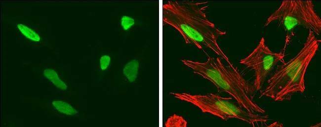 Immunocytochemistry/ Immunofluorescence HMGA2 Antibody (763) - Azide and BSA Free